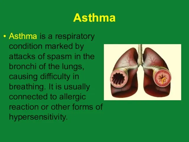 Asthma Asthma is a respiratory condition marked by attacks of spasm in