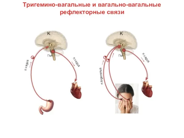 Тригемино-вагальные и вагально-вагальные рефлекторные связи Гт Гт Пм Пм n.vagus n.vagus K K n.trigeminus n.vagus