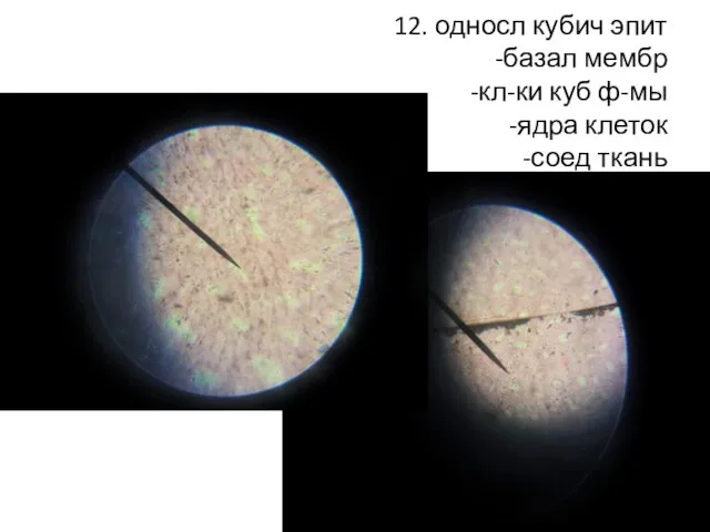 12. односл кубич эпит -базал мембр -кл-ки куб ф-мы -ядра клеток -соед ткань