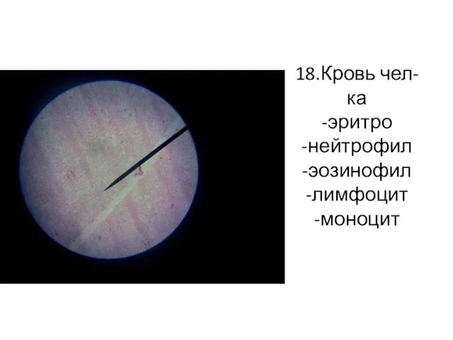 18.Кровь чел-ка -эритро -нейтрофил -эозинофил -лимфоцит -моноцит