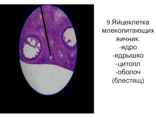 9.Яйцеклетка млекопитающих яичник. -ядро -ядрышко -цитопл -оболоч(блестящ)