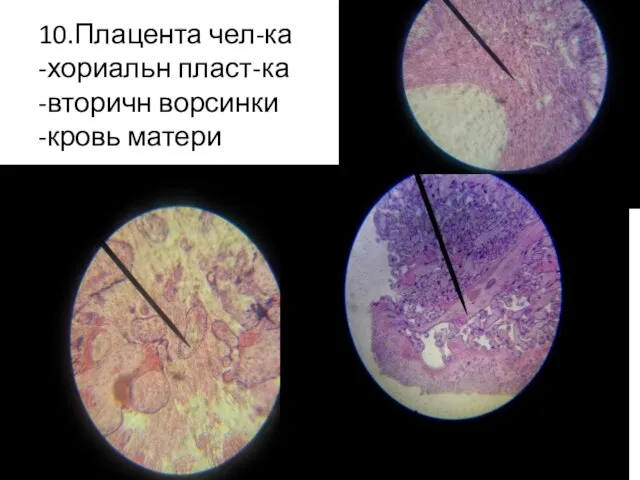 10.Плацента чел-ка -хориальн пласт-ка -вторичн ворсинки -кровь матери