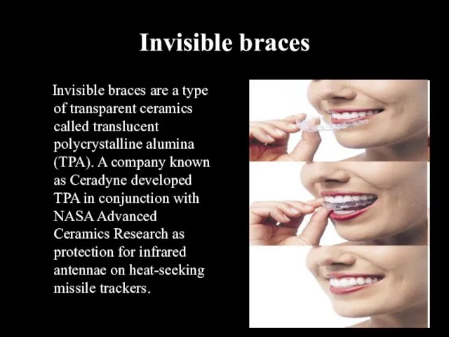 Invisible braces Invisible braces are a type of transparent ceramics called translucent