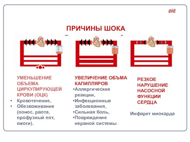 ПРИЧИНЫ ШОКА УМЕНЬШЕНИЕ ОБЪЕМА ЦИРКУЛИРУЮЩЕЙ КРОВИ (ОЦК) Кровотечение, Обезвоживание (понос, рвота, профузный