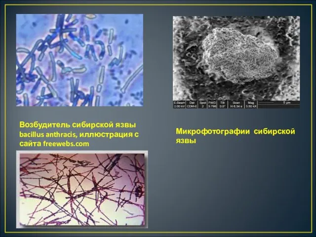 Возбудитель сибирской язвы bacillus anthracis, иллюстрация с сайта freewebs.com Микрофотографии сибирской язвы