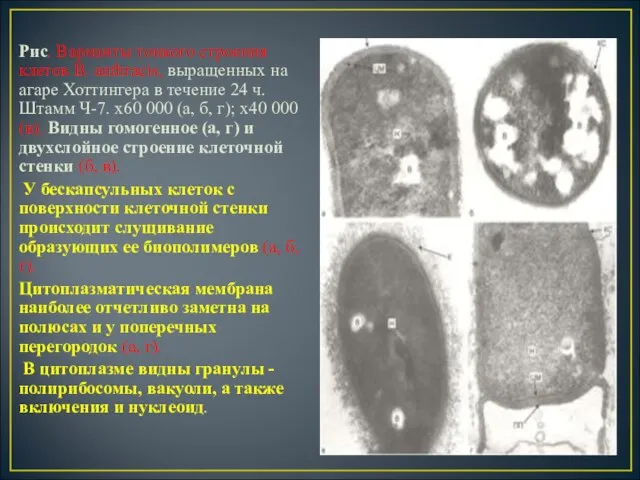 Рис. Варианты тонкого строения клеток В. anthracis, выращенных на агаре Хоттингера в