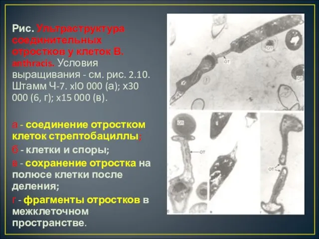 Рис. Ультраструктура соединительных отростков у клеток В. anthracis. Условия выращивания - см.