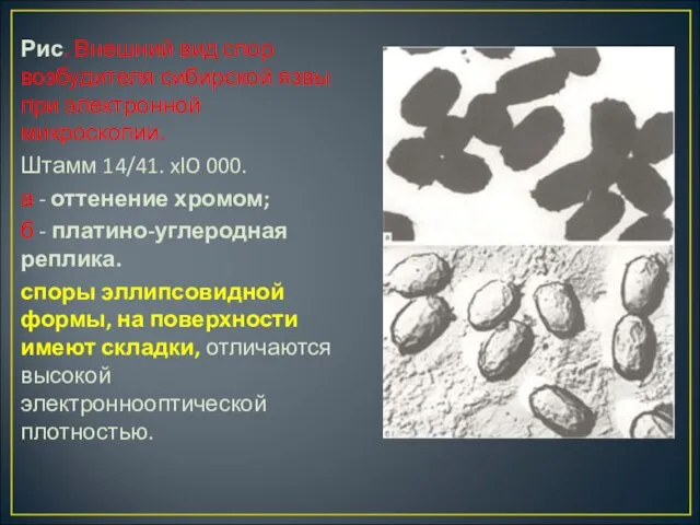 Рис. Внешний вид спор возбудителя сибирской язвы при электронной микроскопии. Штамм 14/41.