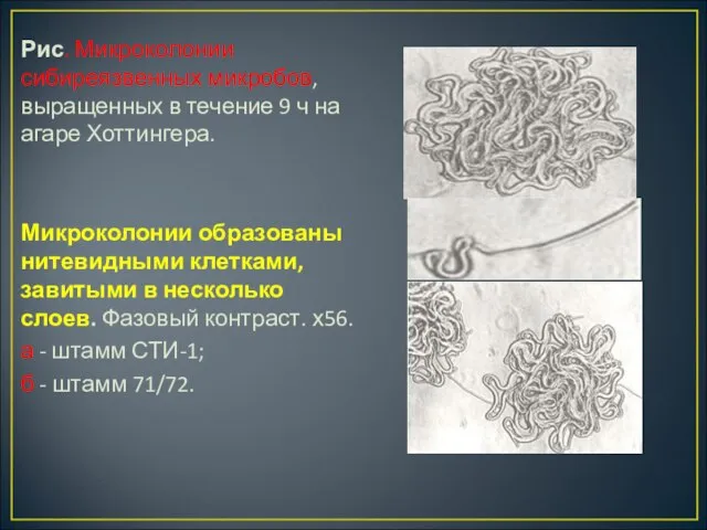 Рис. Микроколонии сибиреязвенных микробов, выращенных в течение 9 ч на ага­ре Хоттингера.