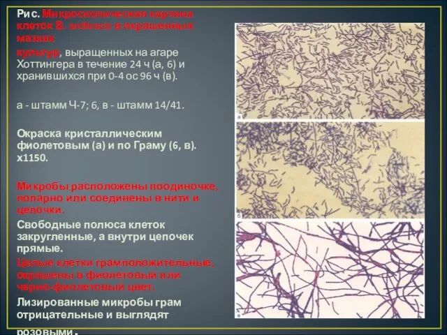 Рис. Микроскопическая картина клеток В. anthracis в окрашенных мазках культур, выращенных на