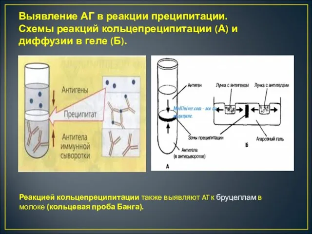 Выявление АГ в реакции преципитации. Схемы реакций кольцепреципитации (А) и диффузии в