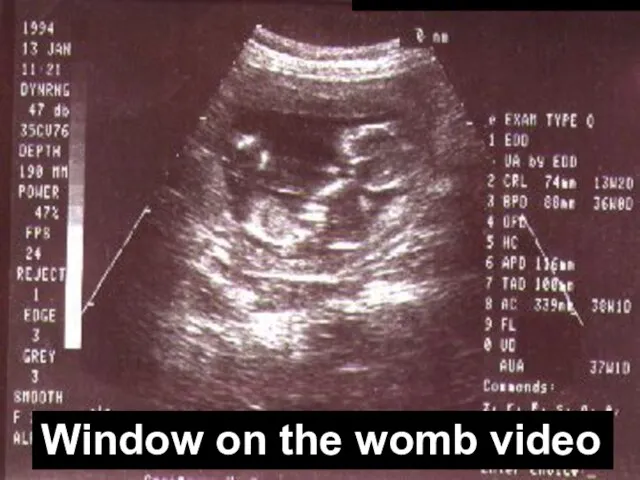 When does life begin? Window on the womb video