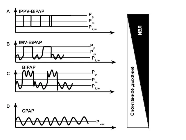 ИВЛ Спонтанное дыхание IPPV-BiPAP IMV-BiPAP BiPAP CPAP Pp Pp Pp Pm Pm