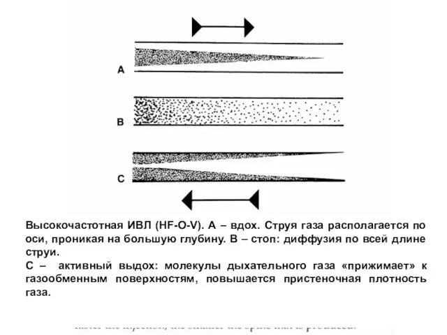 Высокочастотная ИВЛ (HF-О-V). А – вдох. Струя газа располагается по оси, проникая