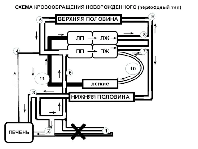 ЛП ПЖ ЛЖ ПП легкие ВЕРХНЯЯ ПОЛОВИНА НИЖНЯЯ ПОЛОВИНА 2 4 3