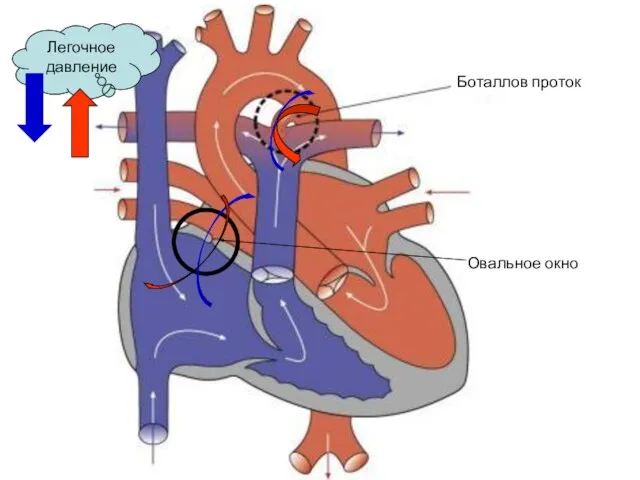 Боталлов проток Овальное окно Легочное давление