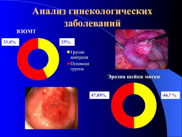 Анализ гинекологических заболеваний 33,6% 25%. 47,05% 46,7 %