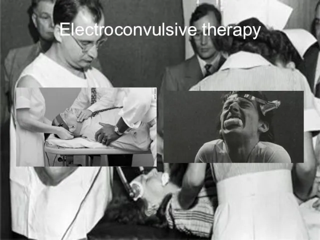 Electroconvulsive therapy