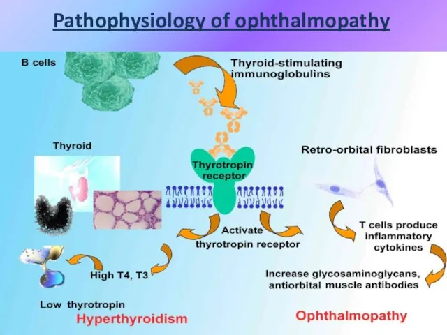 Pathophysiology of ophthalmopathy