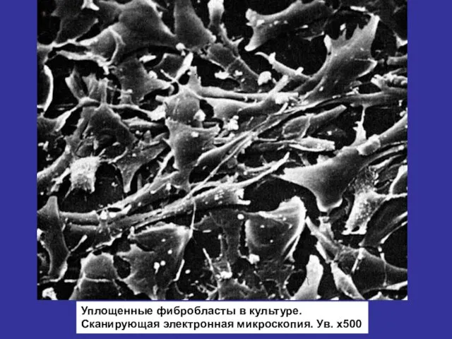Уплощенные фибробласты в культуре. Сканирующая электронная микроскопия. Ув. х500
