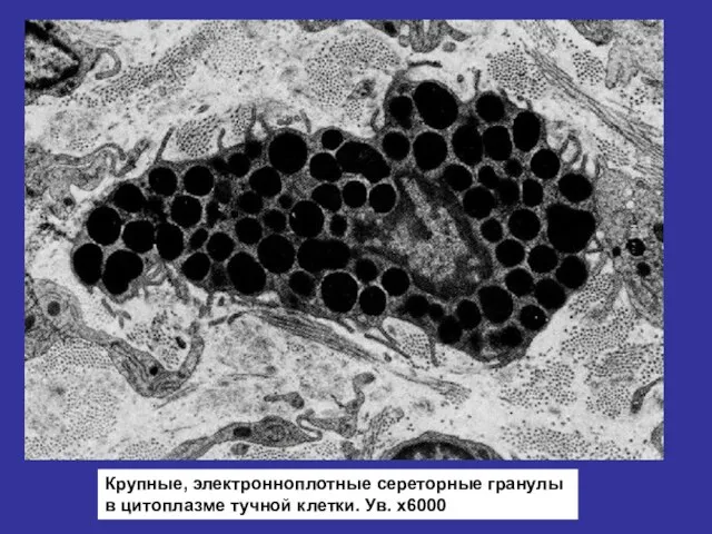 Крупные, электронноплотные сереторные гранулы в цитоплазме тучной клетки. Ув. х6000