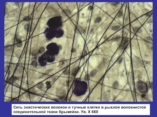 Сеть эластических волокон и тучные клетки в рыхлой волокнистой соединительной ткани брыжейки. Ув. Х 660