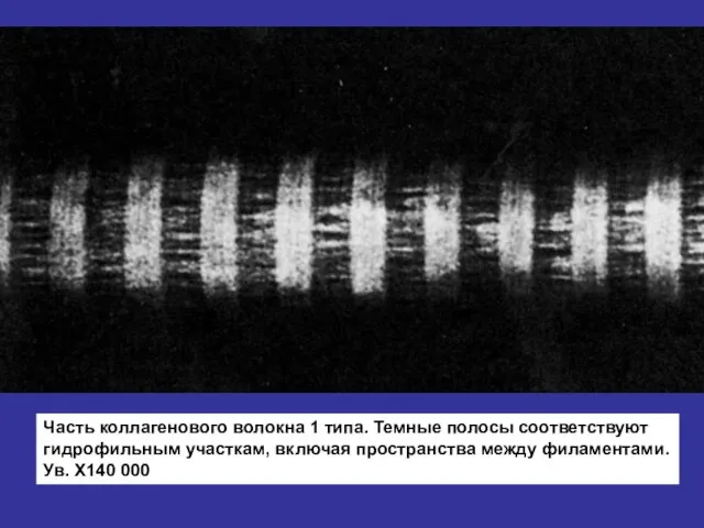 Часть коллагенового волокна 1 типа. Темные полосы соответствуют гидрофильным участкам, включая пространства