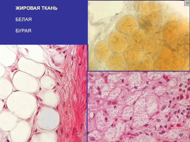 ЖИРОВАЯ ТКАНЬ БЕЛАЯ БУРАЯ