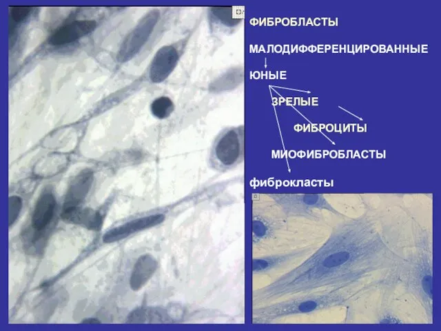 ФИБРОБЛАСТЫ МАЛОДИФФЕРЕНЦИРОВАННЫЕ ЮНЫЕ ЗРЕЛЫЕ ФИБРОЦИТЫ МИОФИБРОБЛАСТЫ фиброкласты