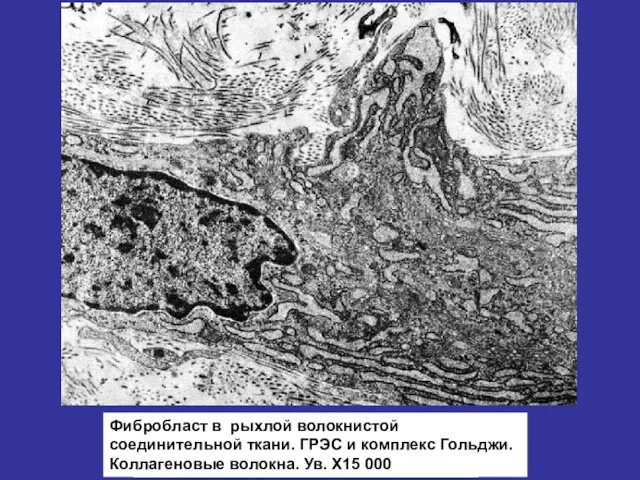 Фибробласт в рыхлой волокнистой соединительной ткани. ГРЭС и комплекс Гольджи. Коллагеновые волокна. Ув. Х15 000