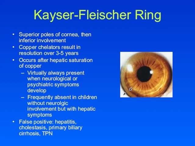 Kayser-Fleischer Ring Superior poles of cornea, then inferior involvement Copper chelators result