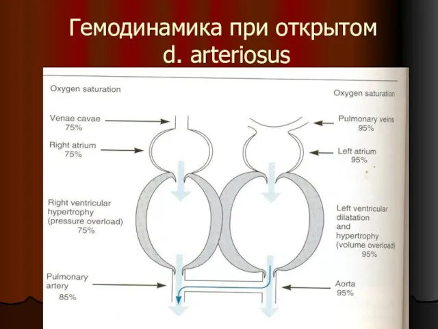 Гемодинамика при открытом d. arteriosus