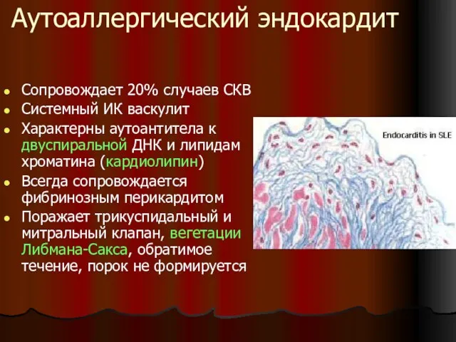 Аутоаллергический эндокардит Сопровождает 20% случаев СКВ Системный ИК васкулит Характерны аутоантитела к