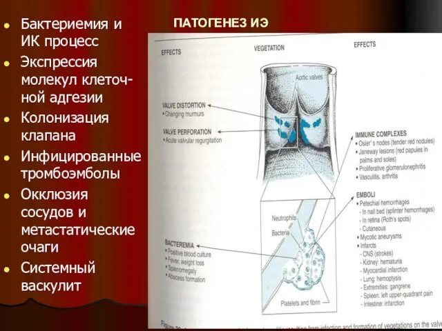 ПАТОГЕНЕЗ ИЭ Бактериемия и ИК процесс Экспрессия молекул клеточ-ной адгезии Колонизация клапана