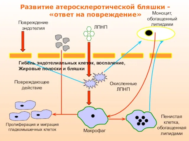 Развитие атеросклеротической бляшки - «ответ на повреждение» Повреждение эндотелия ЛПНП Моноцит, обогащенный