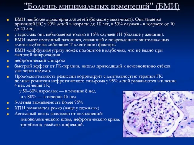 "Болезнь минимальных изменений" (БМИ) БМИ наиболее характерна для детей (больше у мальчиков).