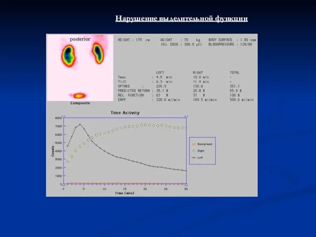 Нарушение выделительной функции