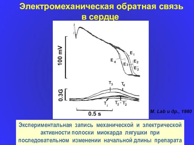 Экспериментальная запись механической и электрической активности полоски миокарда лягушки при последовательном изменении