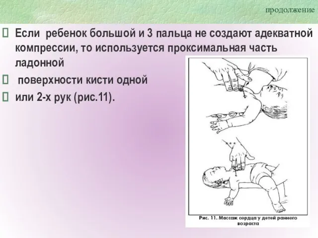 продолжение Если ребенок большой и 3 пальца не создают адекватной компрессии, то