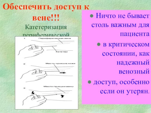 Обеспечить доступ к вене!!! Катетеризация периферической вены Ничто не бывает столь важным