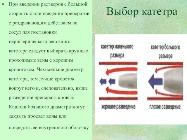 Выбор катетра При введении растворов с большой скоростью или введении препаратов с