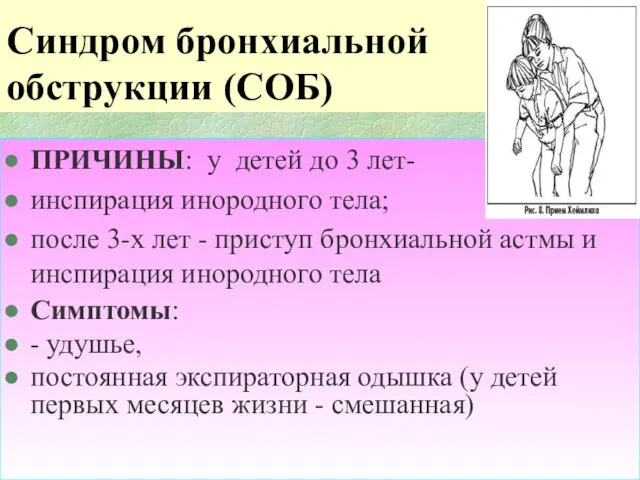 Синдром бронхиальной обструкции (СОБ) ПРИЧИНЫ: у детей до 3 лет- инспирация инородного