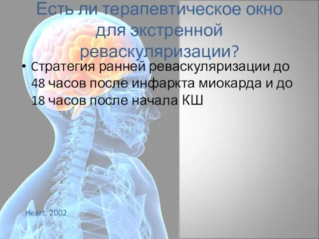 Есть ли терапевтическое окно для экстренной реваскуляризации? Cтратегия ранней реваскуляризации до 48