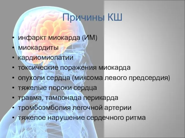 Причины КШ инфаркт миокарда (ИМ) миокардиты кардиомиопатии токсические поражения миокарда опухоли сердца