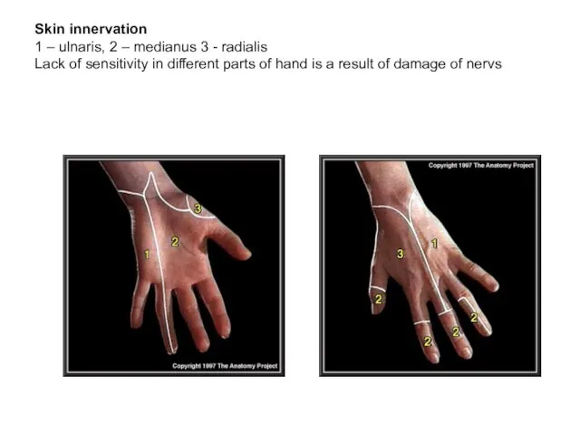 Skin innervation 1 – ulnaris, 2 – medianus 3 - radialis Lack