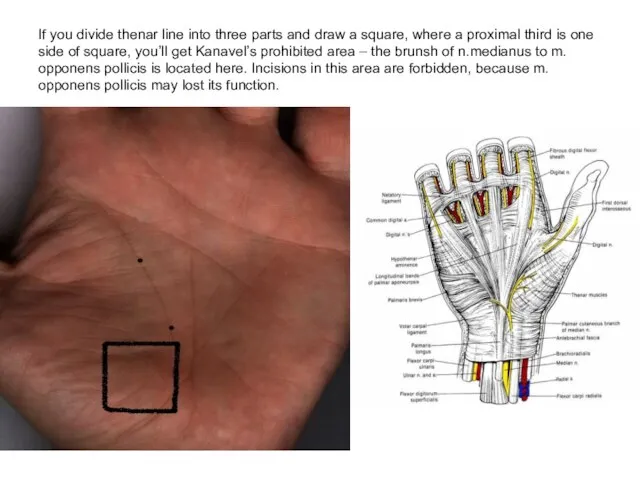 If you divide thenar line into three parts and draw a square,