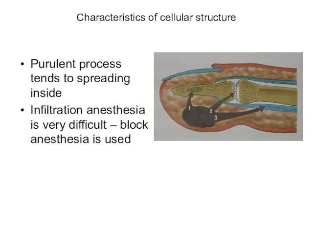 Characteristics of cellular structure Purulent process tends to spreading inside Infiltration anesthesia
