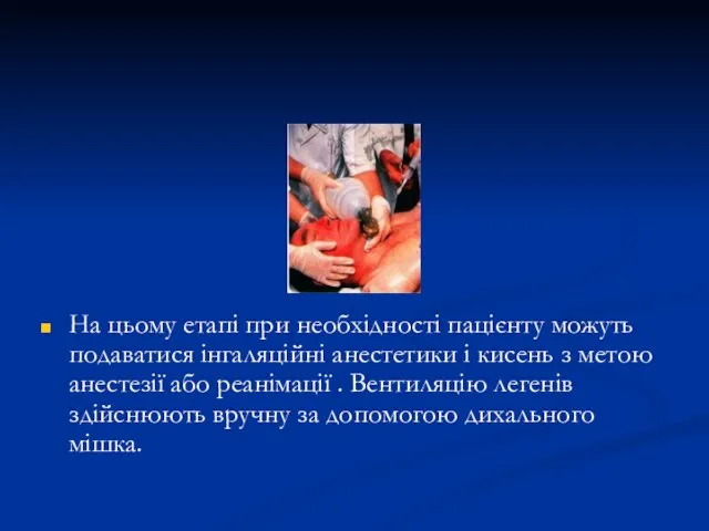 На цьому етапі при необхідності пацієнту можуть подаватися інгаляційні анестетики і кисень