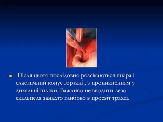 Після цього послідовно розсікаються шкіра і еластичний конус гортані , з проникненням