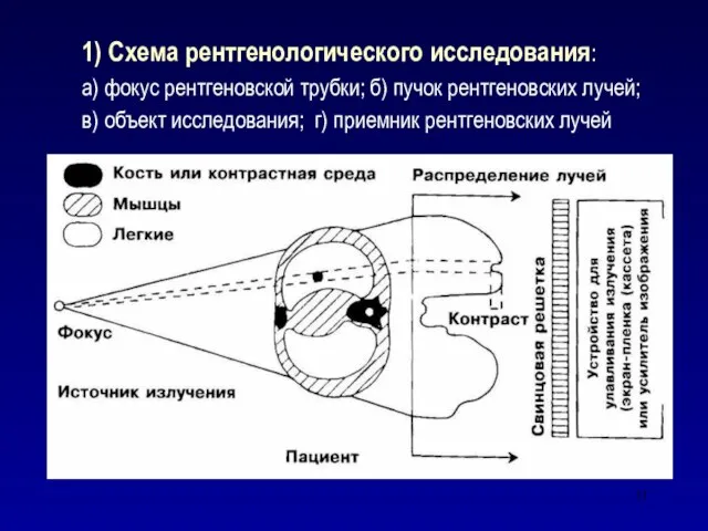 1) Схема рентгенологического исследования: а) фокус рентгеновской трубки; б) пучок рентгеновских лучей;